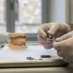 Impianto dentale Arezzo: scelte, diagnosi e manutenzione